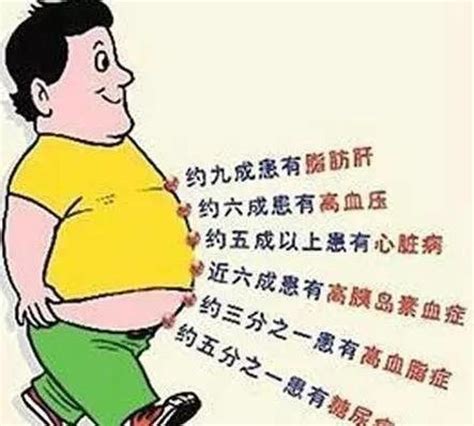 【活动预告】肥胖 不可小觑 减重 刻不容缓