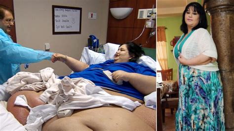 Mayra Rosales Was Nicknamed The Fattest Woman On The Planet Reaching