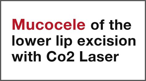 Mucocele Of The Lower Lip Excision With Co2 Laser By Dr S Girish Rao