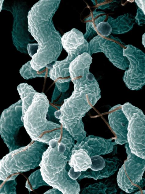 What Is Campylobacteriosis Gabriela Calvi Conexión
