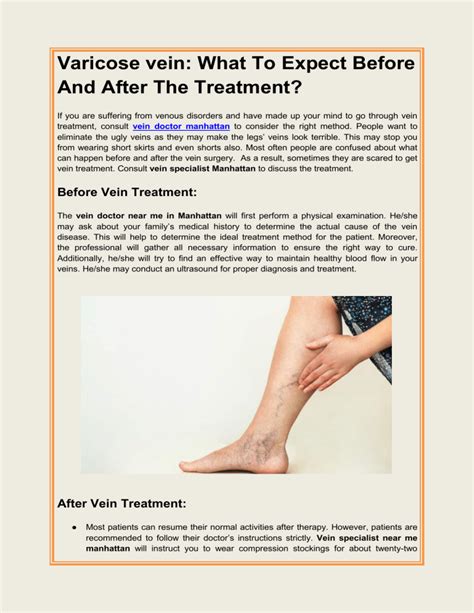 Varicose Vein What To Expect Before And After The Treatment