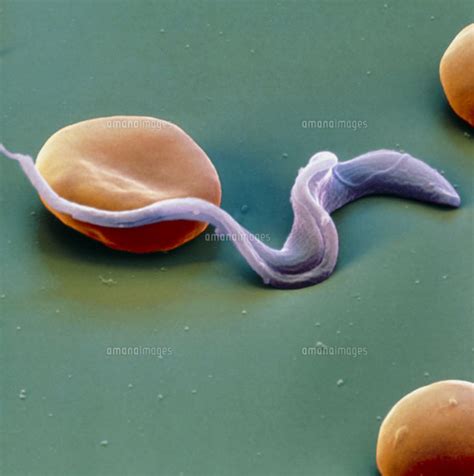 Colour Sem Of Trypansoma Sp Protozoa In Blood 01809020840 の写真素材・イラスト素材