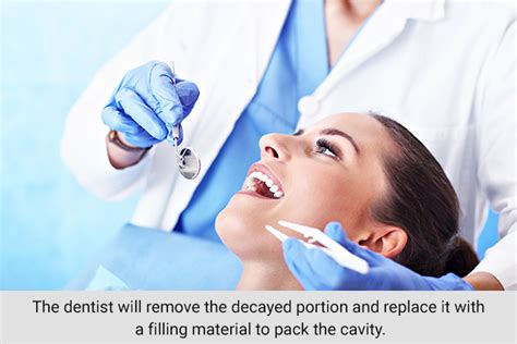 Tooth Decay And Cavities Causes Symptoms And More