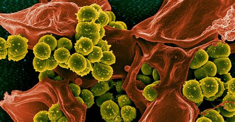 Research Aims To Develop New Treatments For Mrsa Infections