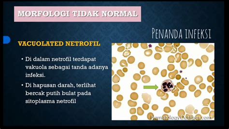 HEMATOLOGI II Jenis Leukosit Normal Dan Kelainan Leukosit YouTube