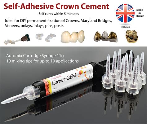 Automix Permanent Dental Cement For Caps Crown Bridges Inlays