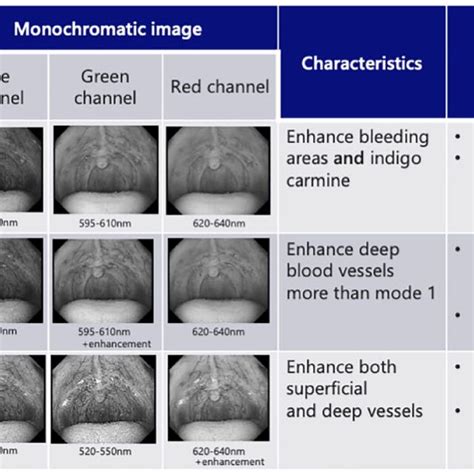 Color Allocations And Three Imaging Modes Of Rdi Rdi Red Dichromatic