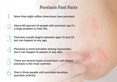 Psoriasis Symptoms Causes Types And Treatments