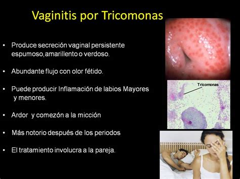 Enfermedades Infecciosas Cervico Vaginales Y Ets En El Siguiente Mapa The Best Porn Website