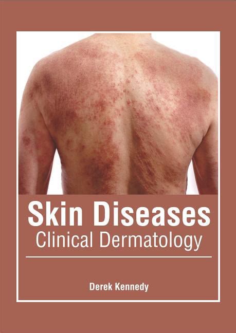 Skin Diseases Clinical Dermatology Hardcover