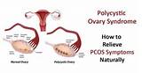 Pictures of Ovary Inflammation Home Remedies