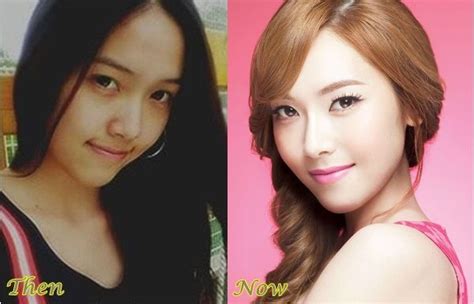 Jessica Snsd Plastic Surgery Before And After Photos Plastic Surgery Surgery Jessica