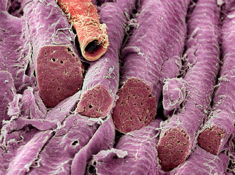 Smooth Muscle Sem Stock Image P1540209 Science Photo Library