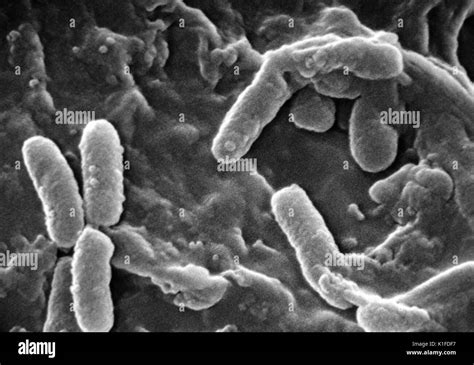 Scanning Electron Micrograph Sem Of Pseudomonas Aeruginosa Bacteria