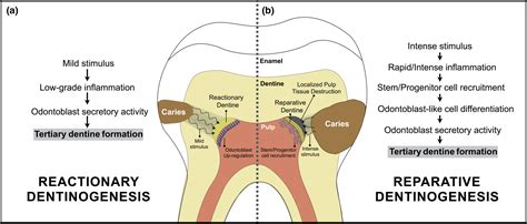 Disclosing The Physiology Of Pulp Tissue For Vital Pulp Therapy Rosa