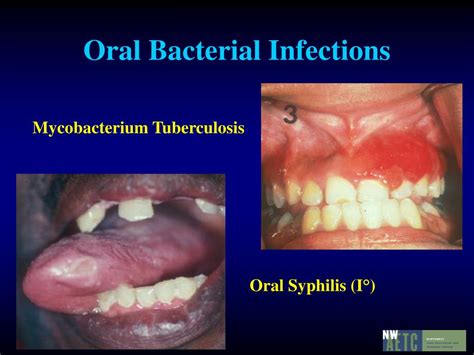 Ppt Oral Health Powerpoint Presentation Free Download Id4540346
