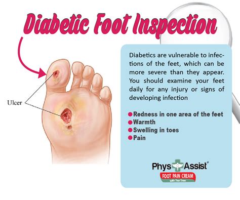 Pathophysiology Of Diabetic Foot Ulcer Simon Peake