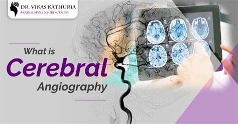 Cerebral Angiography Treatment In Delhi