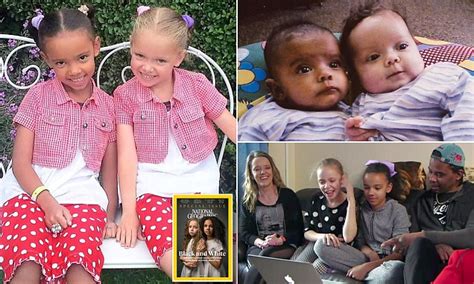 Biracial Twins Reveal What Its Like Growing Up One Black One White