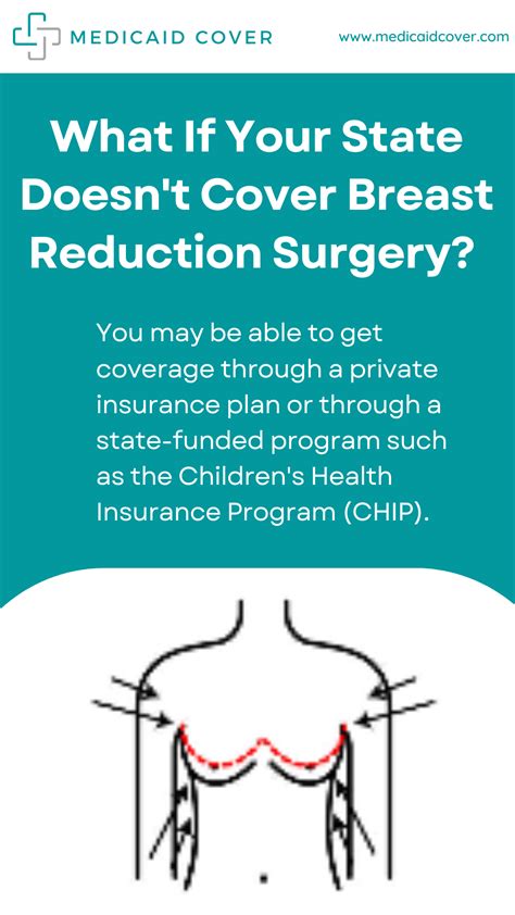 Does Medicaid Cover Breast Reduction Medicaid Cover