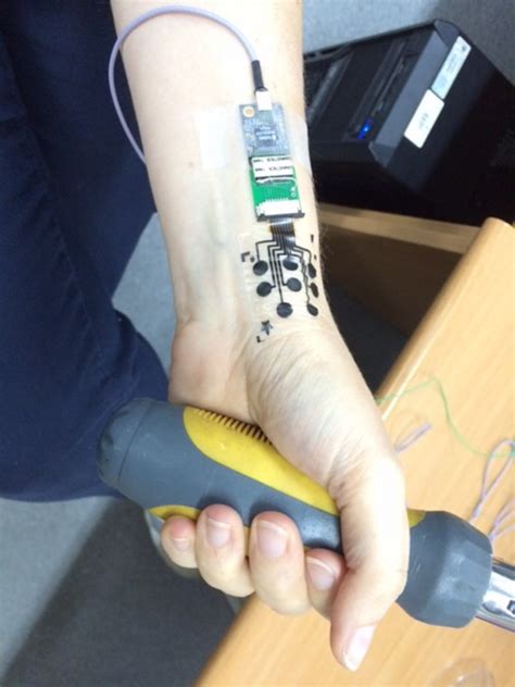 Non Invasive Electric Tattoo For Mapping Muscle Activity Nanotech