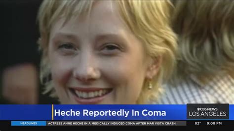 Actress Anne Heche In Critical Condition Her Manager Says Youtube