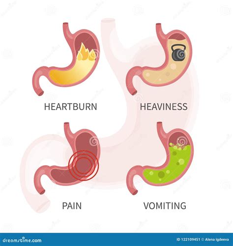 Diseases Of The Stomach Stock Illustration Illustration Of Lifestyle