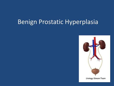 Ppt Benign Prostatic Hyperplasia Powerpoint Presentation Free Download Id