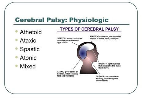 Spastic cp affects about 80% of people with cp. Feeding the Child with Cerebral Palsy - a speech ...