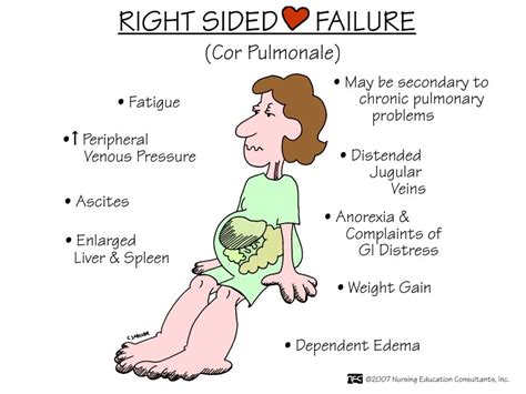 Right Sided Heart Failure Abc Medicine