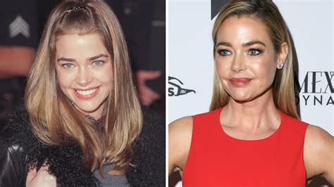 Denise Richards Plastic Surgery Before And After Tovirage
