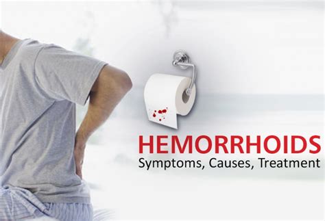 hemorrhoids piles causes symptoms and homeopathic treatment