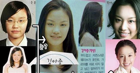 Kim Ah Joong Plastic Surgery Obvious Eye And Nose Job Kim Ah Joong