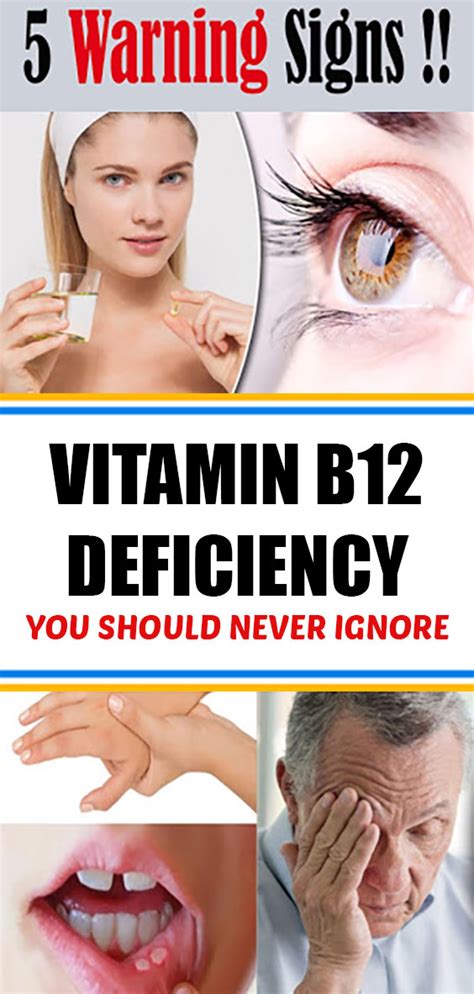 5 warning signs of vitamin b12 deficiency you should never ignore healthcare wellness