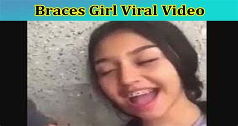 Full Original Video Braces Girl Viral Video Check The Content On Braces Girl Scandal Viral On