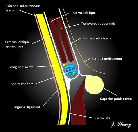 Inguinal Canal Content Anatomy