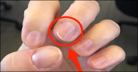 Things Your Nails Can Tell You About Your Health Femanin