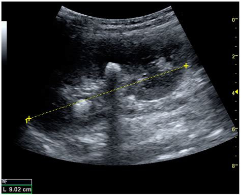 Diagnostics Free Full Text Ultrasonography Of The Kidney A