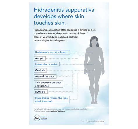 Hidradenitis Suppurativa Signs And Symptoms