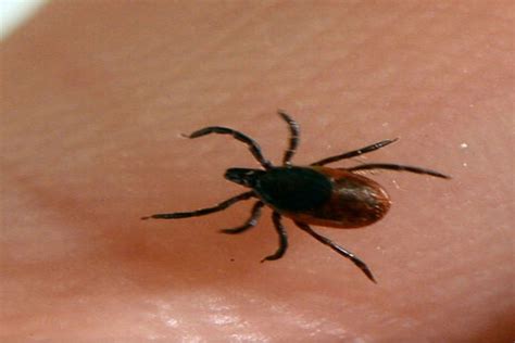 Over 14 Of World Has Had Lyme Disease Study Journalnews