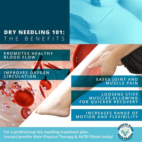 what is dry needling professional physical therapy houston