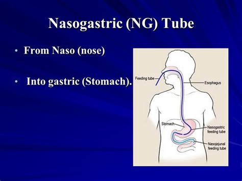 Nasogastric Intubation And Enteral Feedings Ati Template