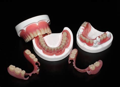 Valplast And Chrome Partials Bci Dental Laboratories