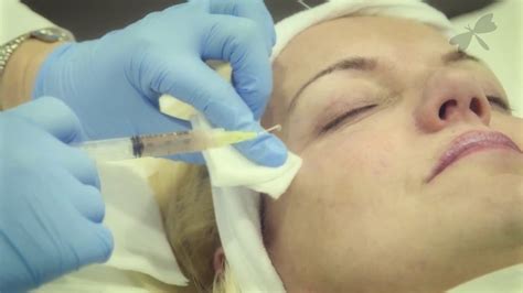 Prp Vampire Facelift The Laser And Skin Clinic Youtube