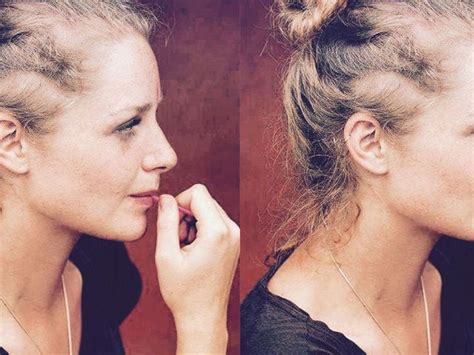 Women Talk About Female Hair Loss What Hair Loss In Women Is Really Like