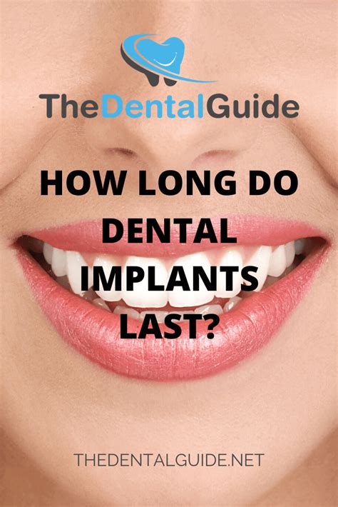 | how long does the tooth extraction process take? How Long Do Dental Implants Last? - The Dental Guide UK