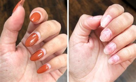 Nails Hurt After Acrylics Everything You Need To Know About Dip