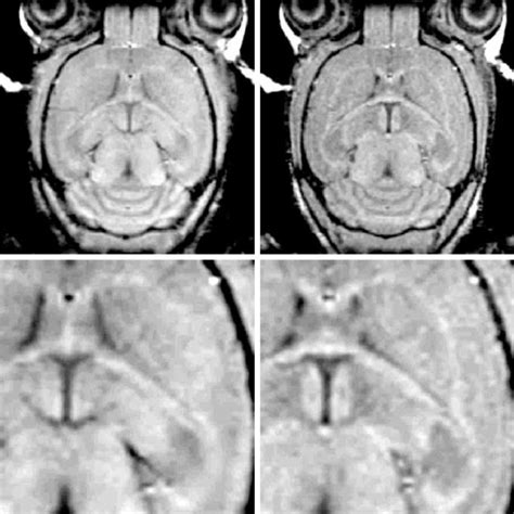 Pdf High Resolution 3d Mri Of Mouse Brain Reveals Small Cerebral