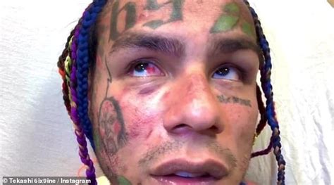 Rapper Tekashi 6ix9ine Is Arrested In Florida For Failing To Show Up