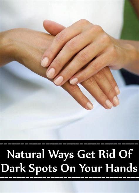 7 Natural Ways Get Rid Of Dark Spots On Your Hands Agespotsproducts